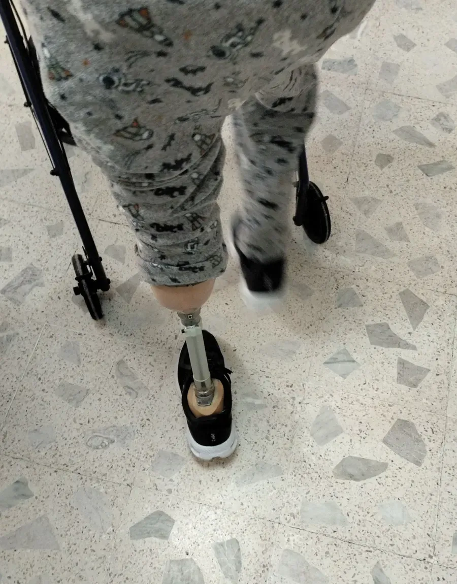 Paciente caminando con su prótesis de pierna y andadera en el consultorio